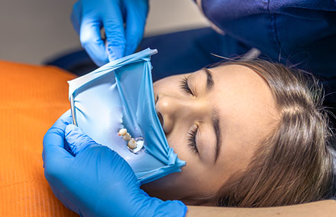 img-Tooth Extractions