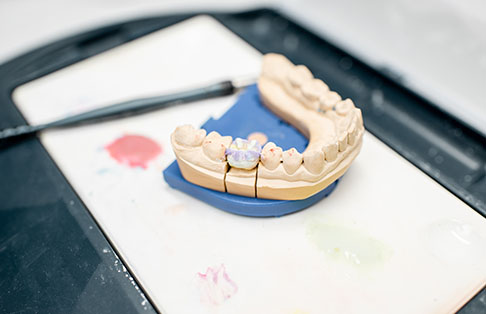 img-crowns